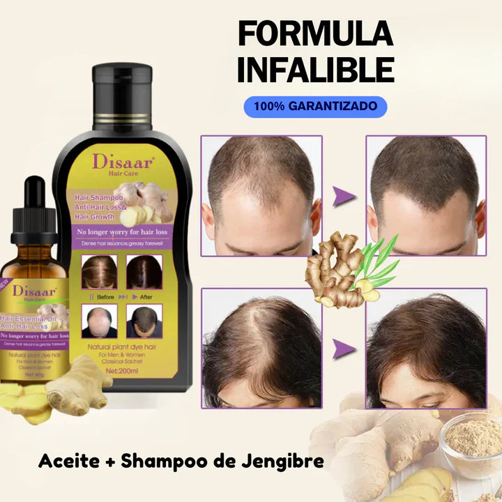 PACK ANTI CAIDA (1 SHAMPOO ORGANICO JENGIBRE + 1 ACEITE SERUM) 🌿 - ( Pagar en Casa al recibir )