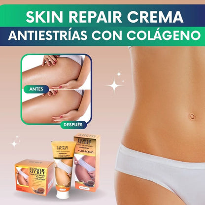 Skin Repair - Crema antiestrías con Colageno